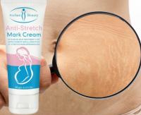 ফাটা দাগ রিমুভাল ক্রীম – প্রেগনেন্সি ও বডি স্ট্রেচ মার্ক দূর করার ন্যাচারাল সমাধান