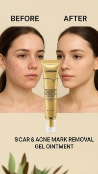LANBENA Scar & Acne Mark Removal Gel – দাগ, ব্রণ ও অ্যাকনে স্পট রিমুভার | 30g অরিজিনাল