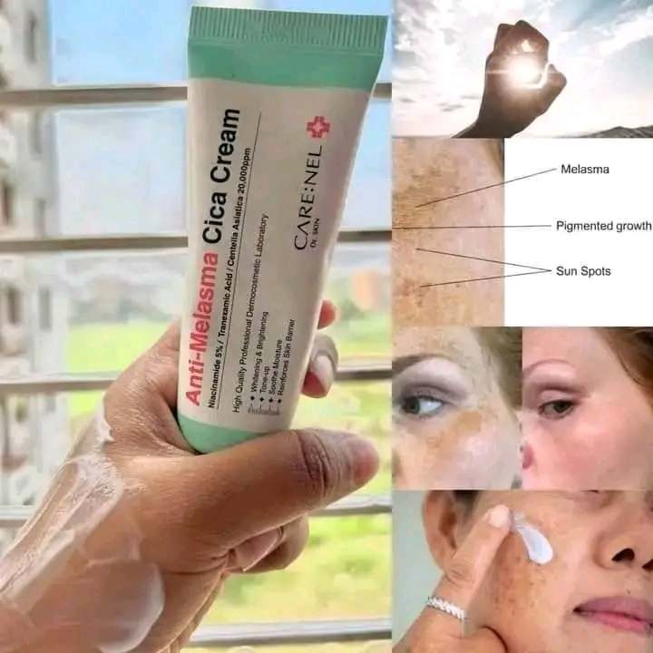 Anti Melasma Cica Cream – মেলাসমা & ডার্ক স্পট রিমুভার | Bright & Glowing Skin Solution